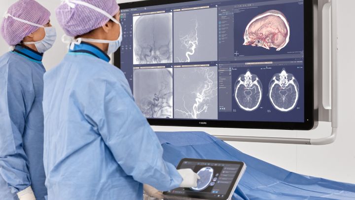Neurovascular care thumbnail