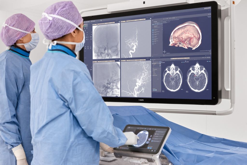 SmartCT Dual Phase Cerebral Neuro imaging technology