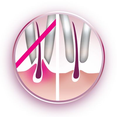 Diski za nežno puljenje pri odstranjevanju dlačic ne vlečejo kože