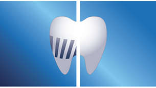 Iki 75 % efektyvesnis valymas, palyginti su įprastu dantų šepetėliu