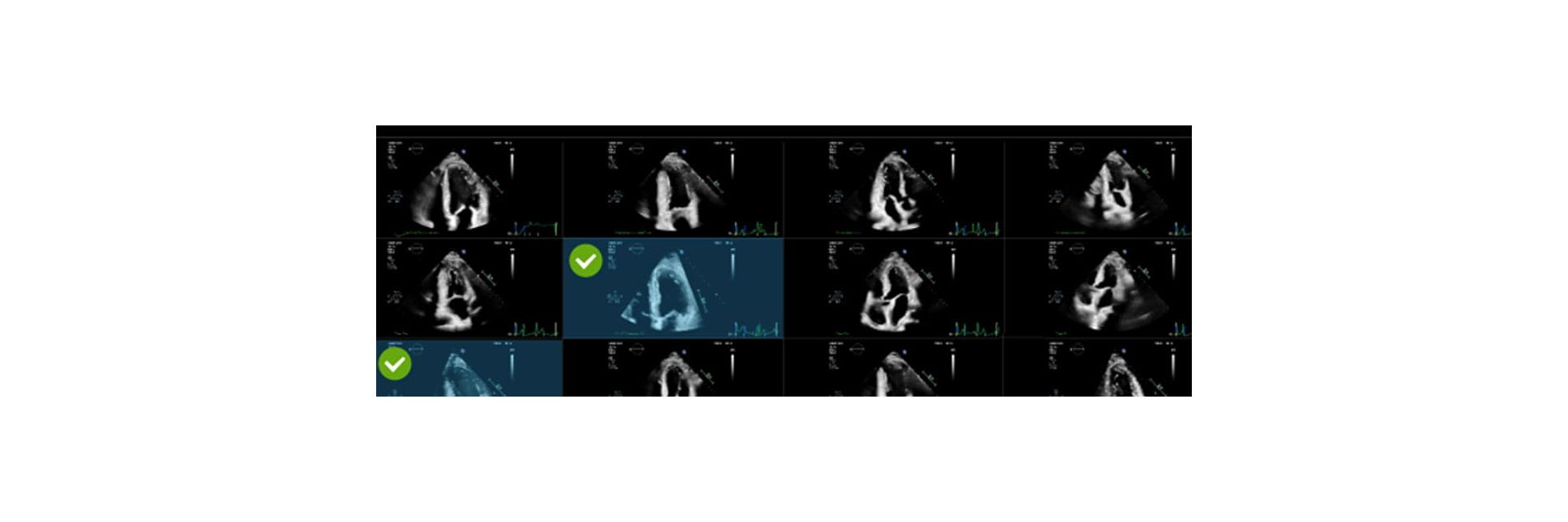 AI edited Echo with EPIQ Cvx image
