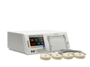 Avalon Monitor fetal intraparto