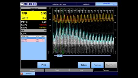 Simplifying physiology