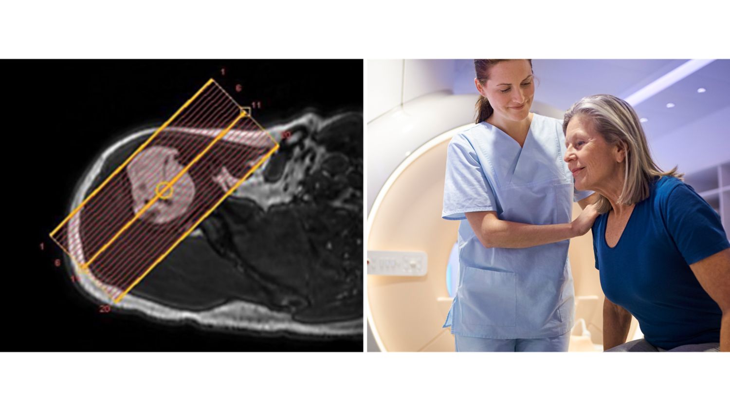 MRI examinations benefitting from automation