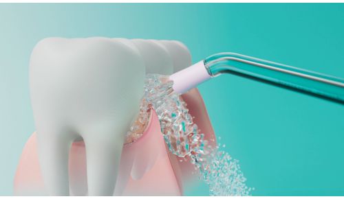 Quadstream-teknologi: Fjerner plak fra under tandkødsranden