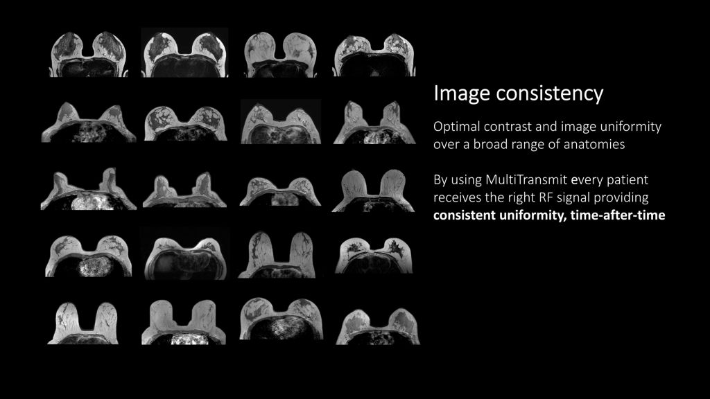 Clinical image 3.0T MR technology MultiTransmit