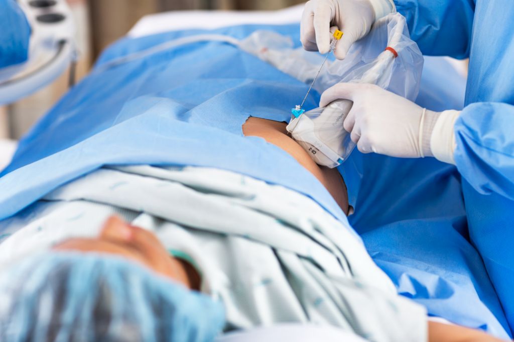 Ultrasound Liver Biopsy with C9-2