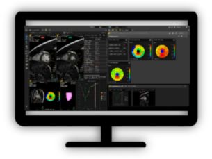 MR Cardiac Detailed quantification of cardiac function