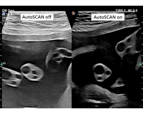 Autoscan off and autoscan on comparison