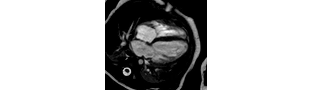 4 chamber cine (5 kg)