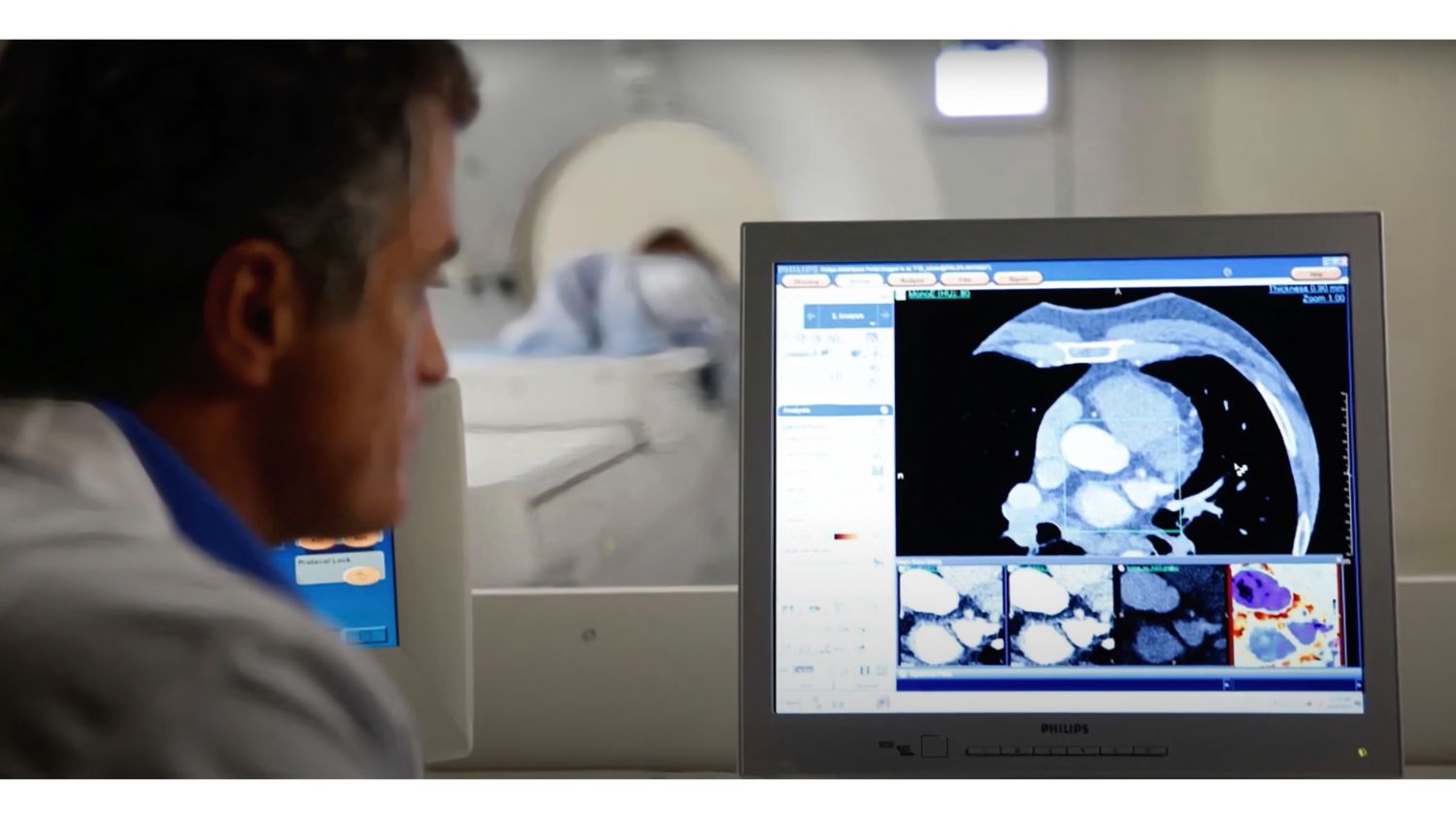 Dr. Eliseo Vañó Galván of Hospital Nuestra Señora del Rosario discusses his experience using spectral-detector CT