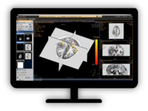 MR Brain Function Analysis Brain activation analysis