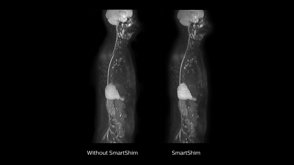 SmartShim