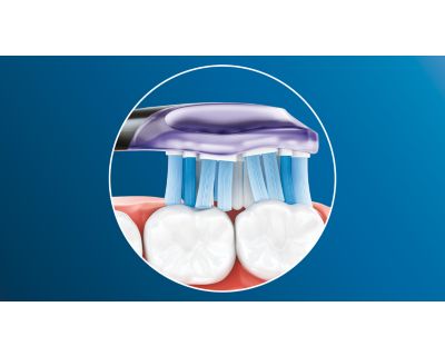 Adaptive cleaning technology