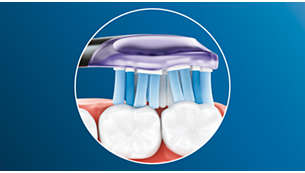 歯や歯ぐきの形状にフィットしてしっかり歯垢を除去