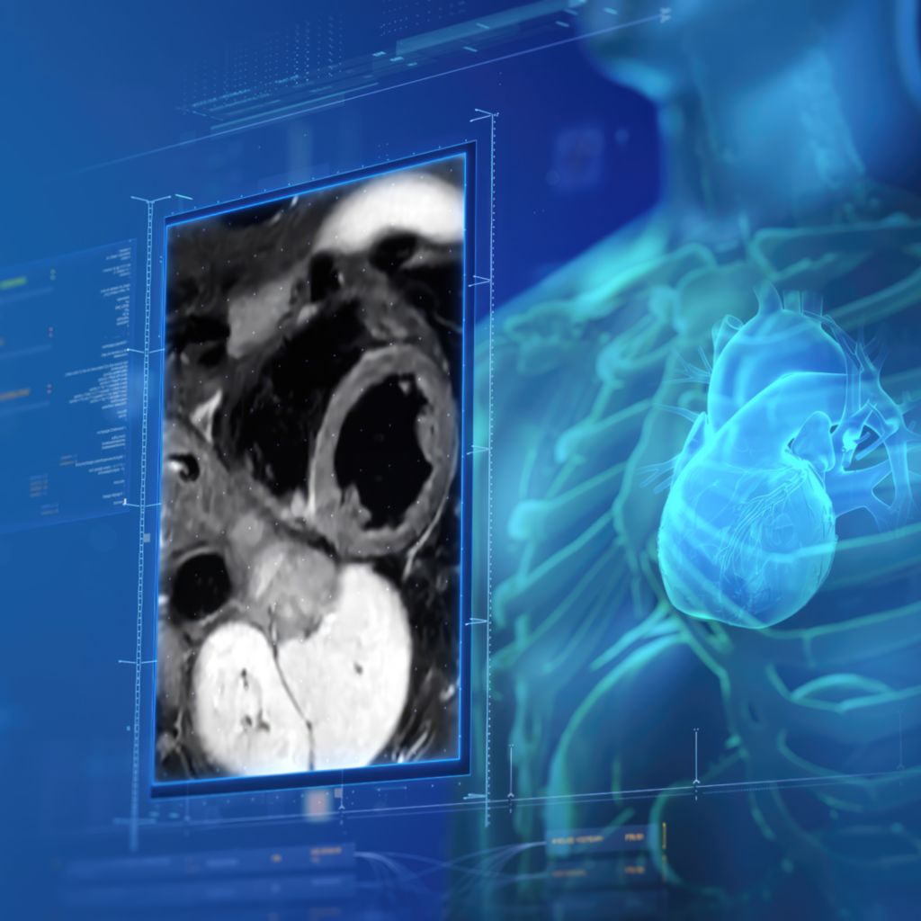 Cardiac imaging with SmartSpeed