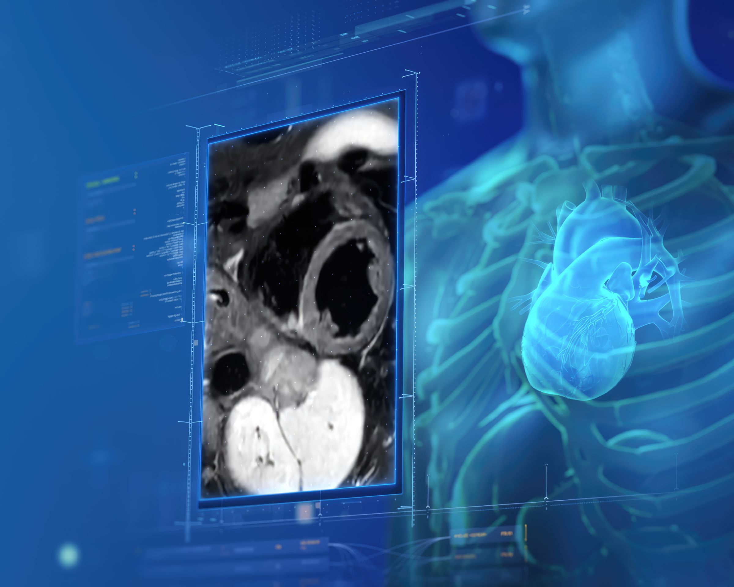 Cardiac imaging with SmartSpeed