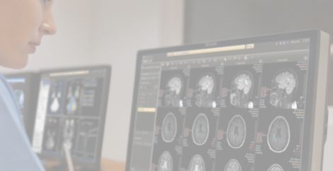 IntelliSpace Portal 11 Eine Arbeitsumgebung, eine fortschrittliche Bildgebungslösung