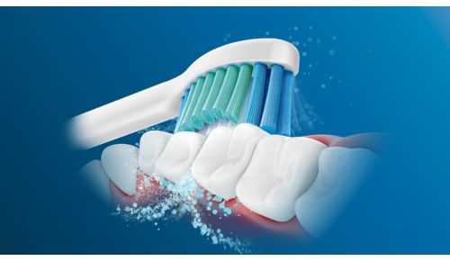 Philips Sonicare geavanceerde sonische technologie