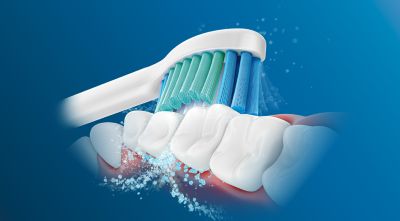Tecnologia sonica avanzata Philips Sonicare