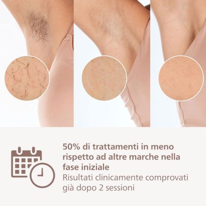 Philips Lumea IPL 8000 Series