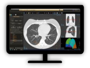 CT Lung Nodule CAD Automated computer aid for lung nodule detection