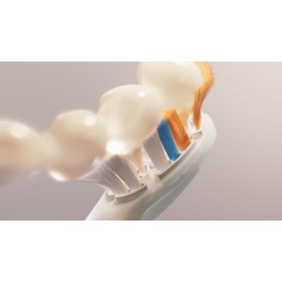 Sonicare Brush Heads Portfolio  Feature Image (PPL) Extra care for gums