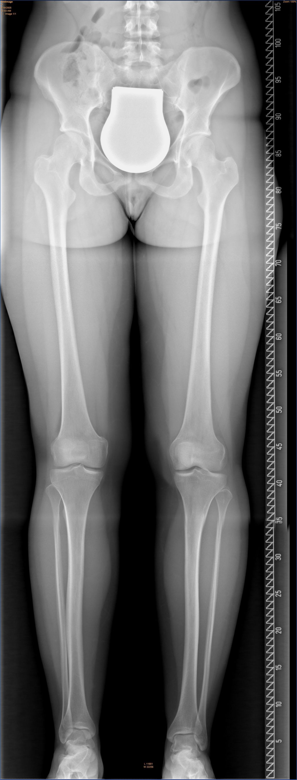 Automatic image stitching