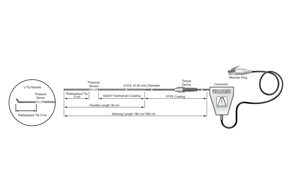 The Verrata’s preformed J-shaped tip is always directed toward the sensor, guarding against whipping artifact. The pressure guide wire is a steerable guide wire with a pressure transducer mounted 3 cm proximal to the tip and has a diameter of 0.014" (0.36 mm) and is available in lengths of 185 cm or 300 cm and also in straight or pre-shaped tips.