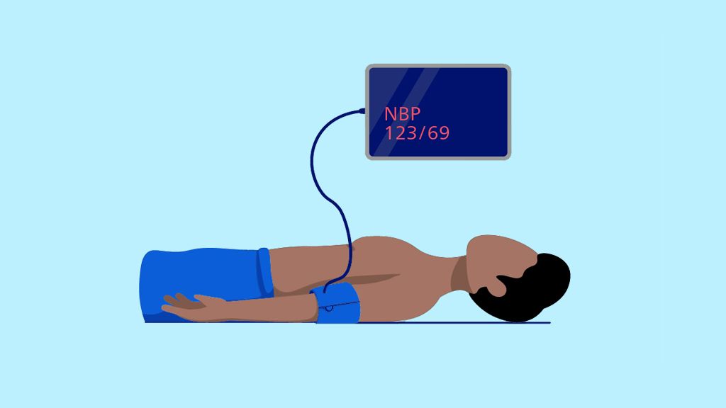illustration showing automated NBP measurement