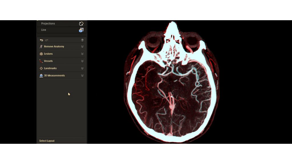 SmartCT Dual Viewer