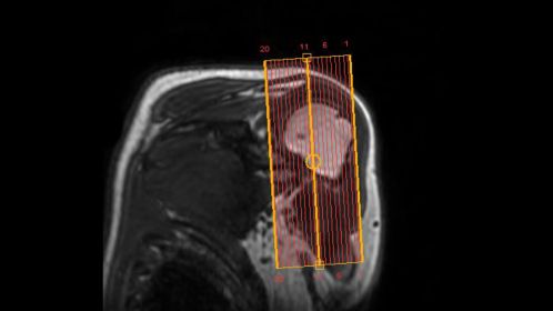 SmartExam Shoulder