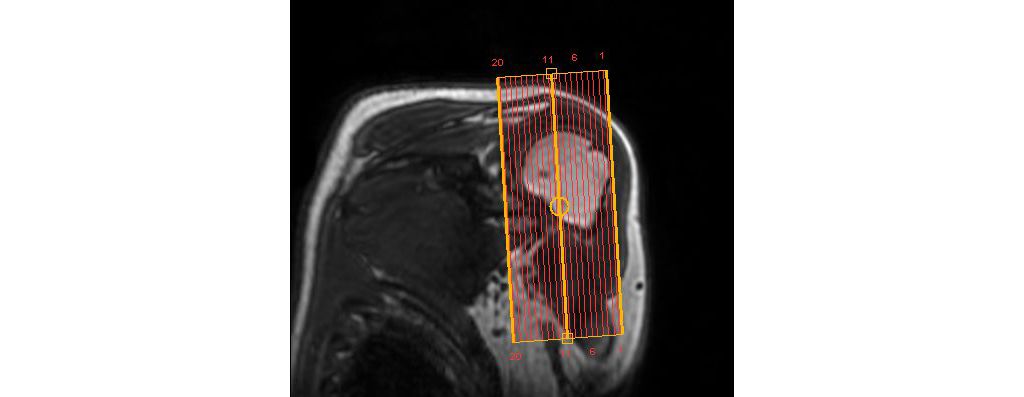 SmartExam Shoulder