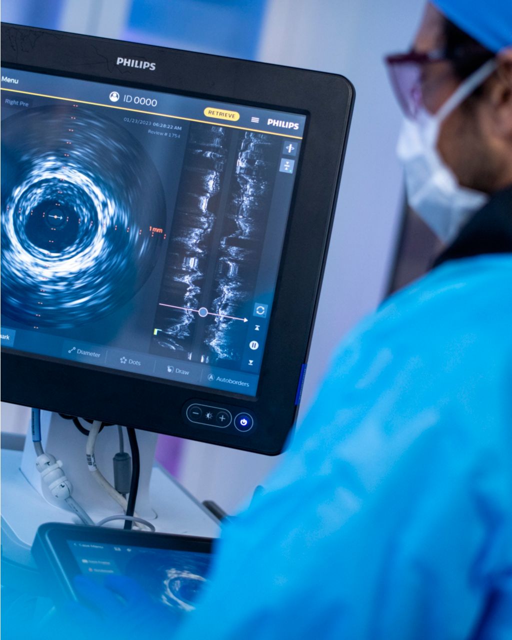 Physician looking at an IVUS image on Philips Intrasight Mobile