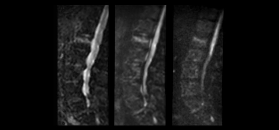 Zoom Diffusion (b0, b400 and b1000)