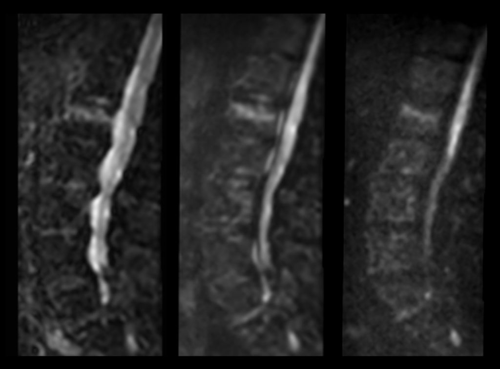 Zoom Diffusion (b0, b400 and b1000)