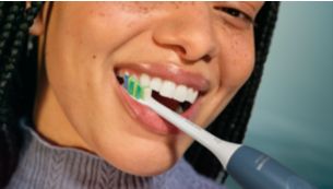 Easy switch to electric brushing