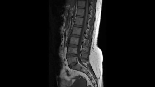 Sagittal T1w TSE 