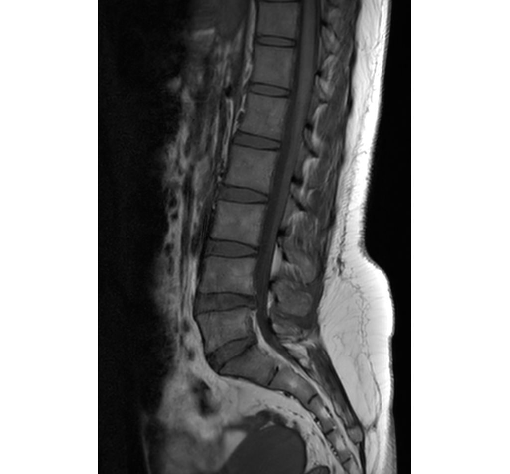Sagittal T1w TSE 