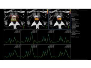 Spectroscopy - Pelvis MR clinical application