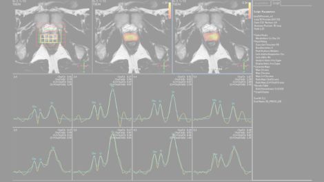 Spectroscopy Клиническое приложение для МР-исследований