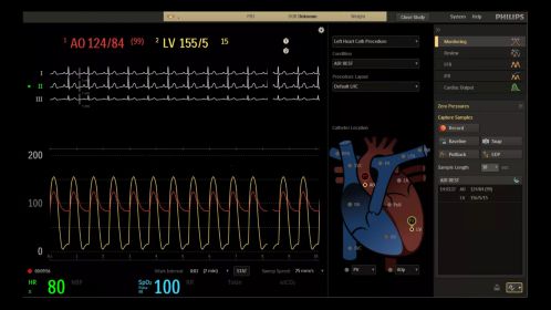 Hemo user interface TAVI control room