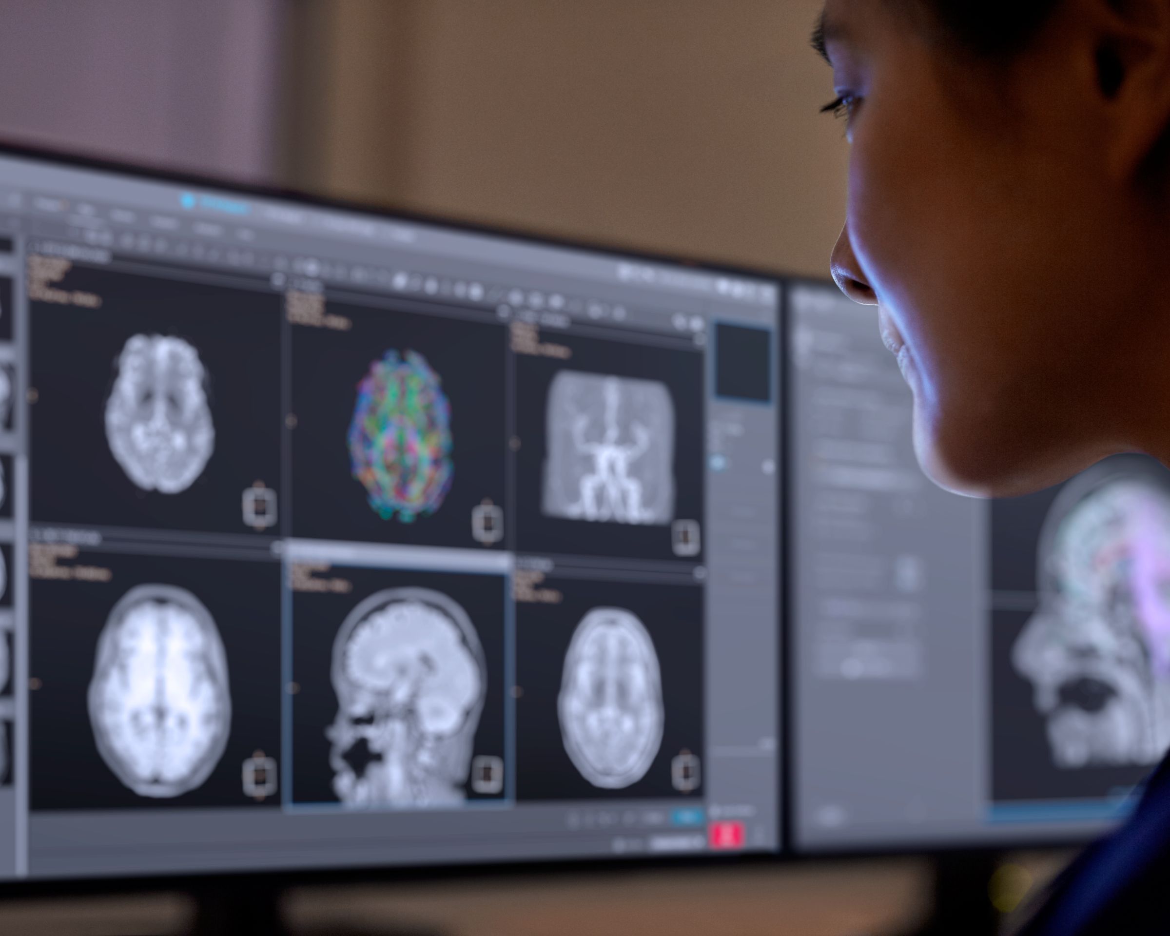 Technologist sitting behind MR console using AI-based protocol assistant