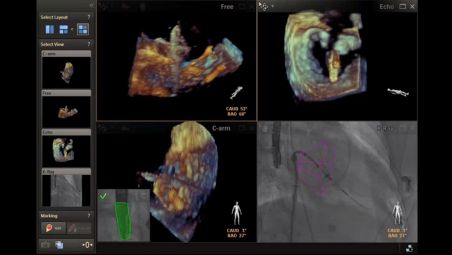 Three perspectives for enhanced visualization of situation