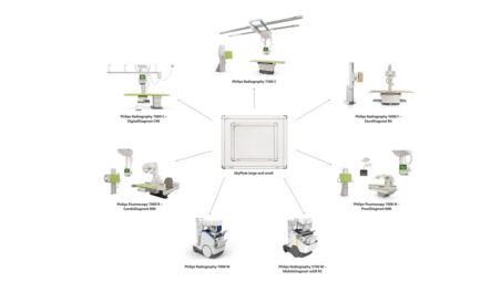 Harmonization across Philips DXR