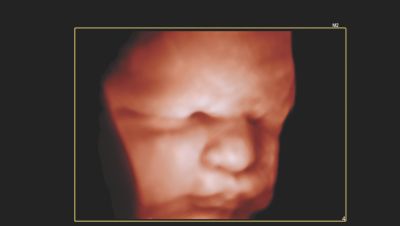 3D の胎児の顔