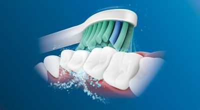 Philips Sonicare's advanced sonic technology