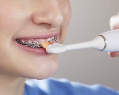 Patient with braces brushing front of braces.