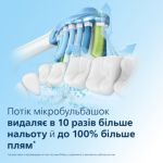 Біла усмішка без зусиль