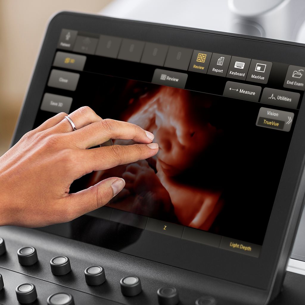 TouchVue touchscreen with OB ultrasound image